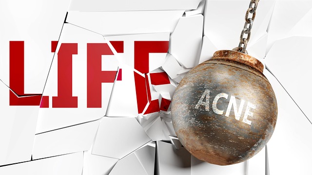 Cilt Lekeleri İçin Aloe Vera Maskesi